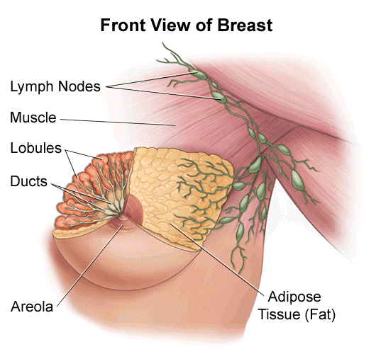شماتیک سرطان پستان