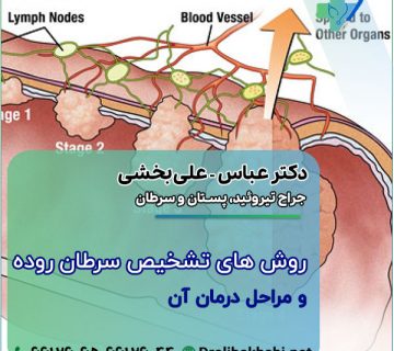 روش های تشخیصی سرطان روده و مراحل درمان