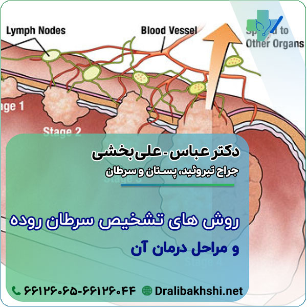 روش های تشخیصی سرطان روده و مراحل درمان