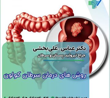 روش های درمان سرطان کولون