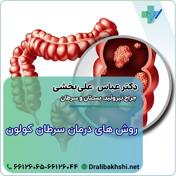 روش های درمان سرطان کولون