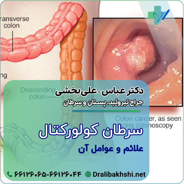 سرطان کولورکتال، علائم و عوامل آن