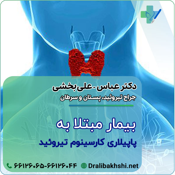 پاپیلاری کارسینوم تیروئید