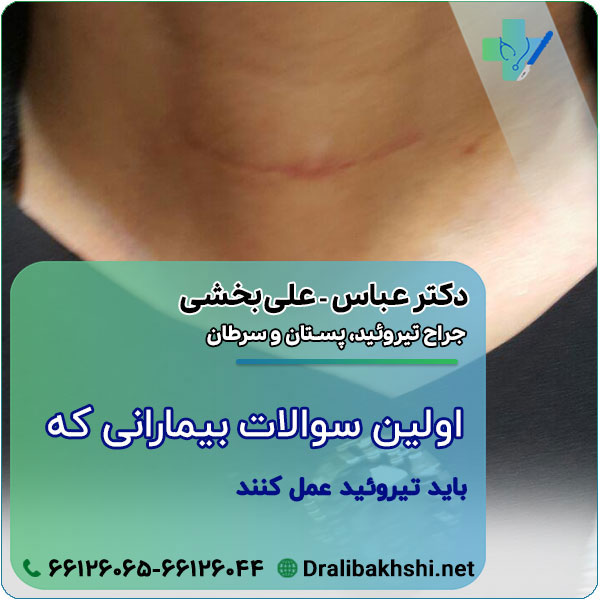 اولين سوالات بيمارانی كه باید تیروئید عمل کنند