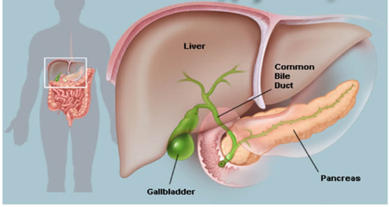 درمان سرطان کیسه صفرا با کمک جراحی