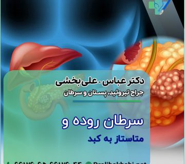 سرطان روده و متاستاز به کبد