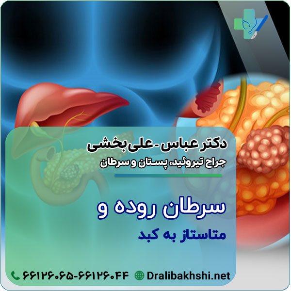 سرطان روده و متاستاز به کبد