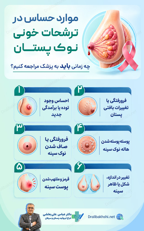 موارد حساس در ترشحات خونی نوک پستان