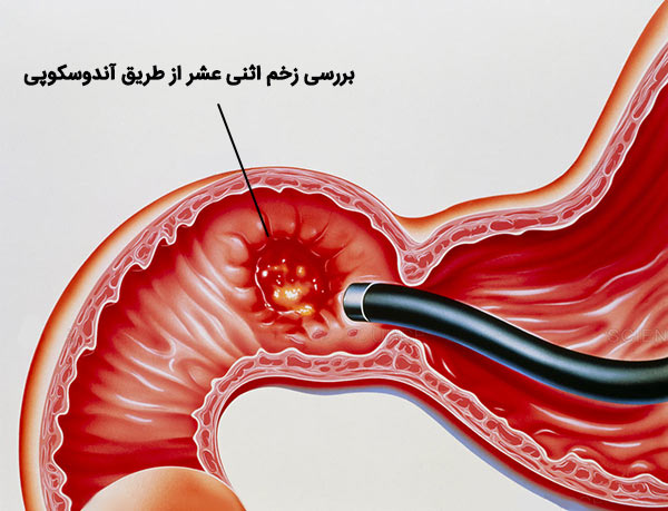 زخم اثنی عشر