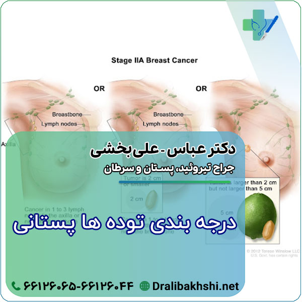 درجه بندی توده های پستانی