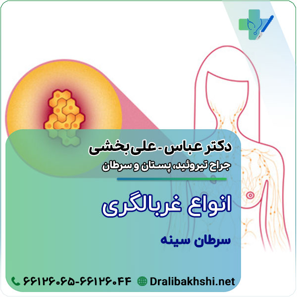انواع غربالگری سرطان سینه
