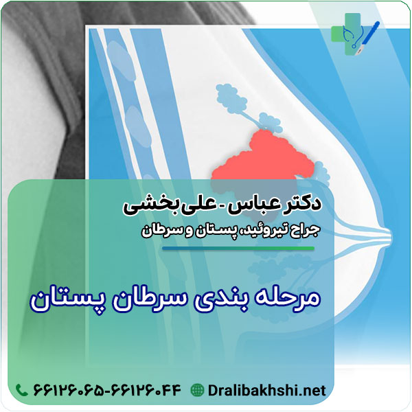 علائم اختصاری مرحله بندی سرطان پستان