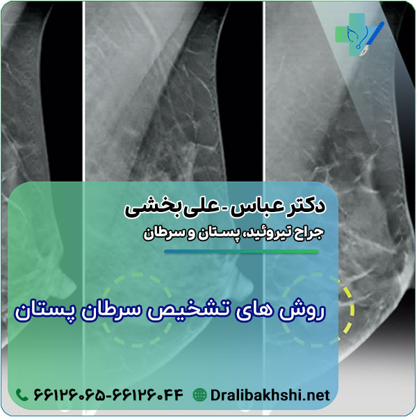 روش های تشخیص سرطان پستان