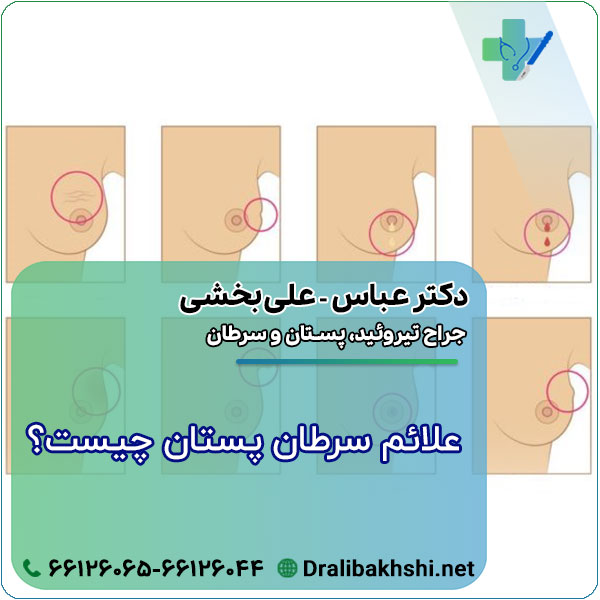 علائم سرطان پستان چیست؟