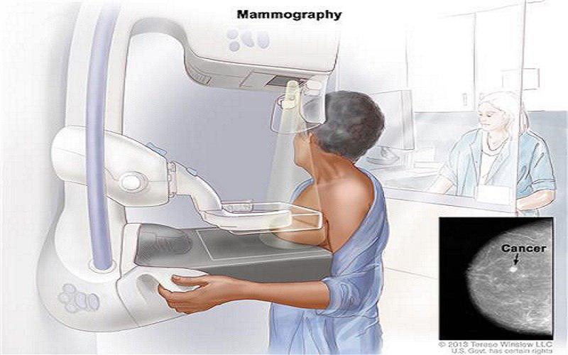 انجام اولین ماموگرافی در افراد عادی از چه سنی توصیه می شود؟ | دکتر علی بخشی