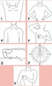 معاینه سرطان سینه