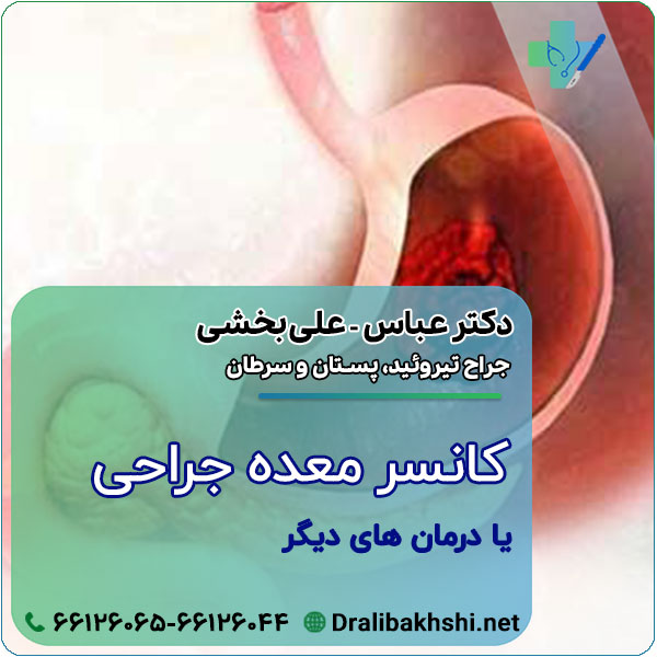 کانسر معده؛ جراحی یا درمان های دیگر؟