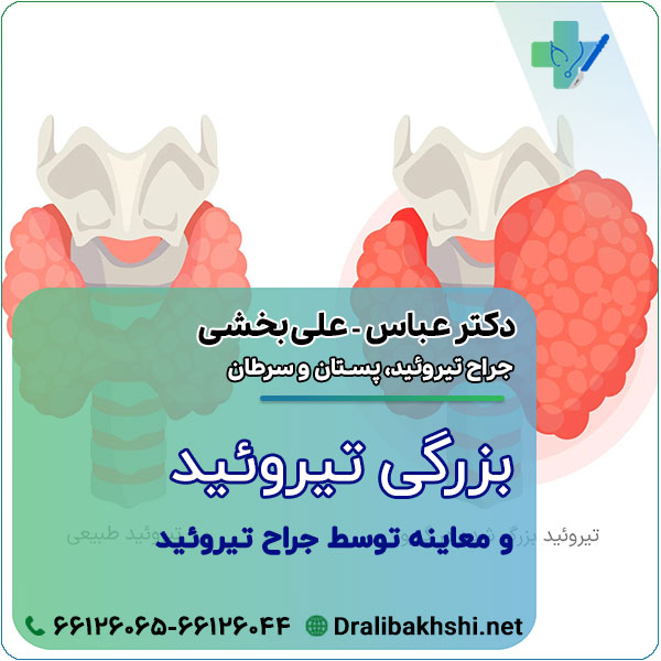 بزرگی تیروئید و معاینه توسط جراح تیروئید