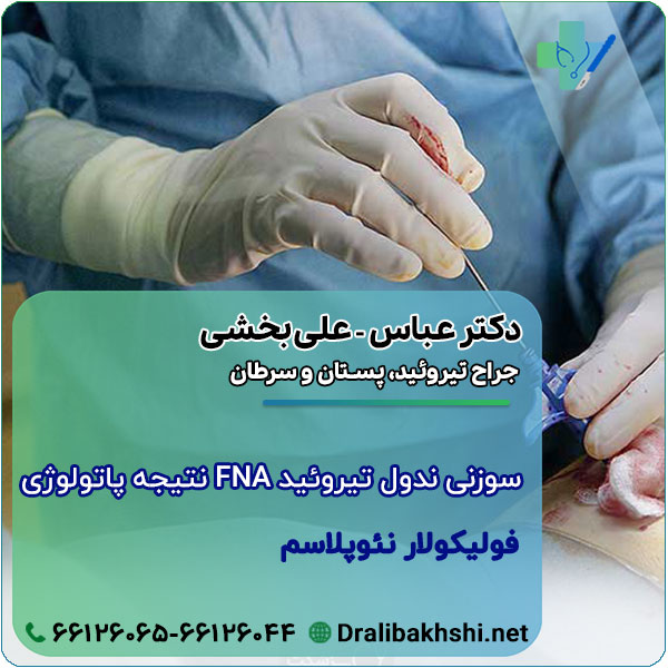 نتیجه پاتولوژی FNA سوزنی ندول تیروئید: فولیکولار نئوپلاسم