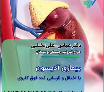 بیماری آدیسون یا اختلال و نارسایی غدد فوق کلیوی