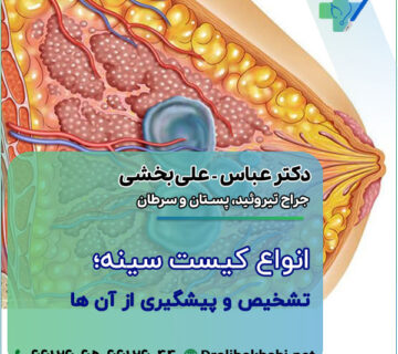انواع کیست سینه؛ تشخیص و پیشگیری از آن ها