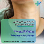 بیماری گواتر چیست و چه زمانی نیاز به جراحی دارد؟