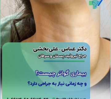 بیماری گواتر چیست و چه زمانی نیاز به جراحی دارد؟
