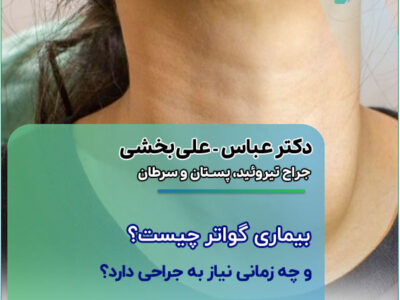 بیماری گواتر چیست و چه زمانی نیاز به جراحی دارد؟ بیماری گواتر چیست و چه زمانی نیاز به جراحی دارد؟