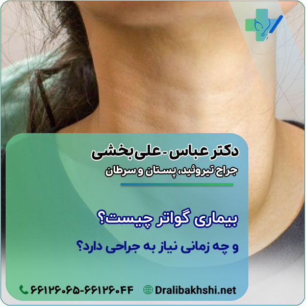 بیماری گواتر چیست و چه زمانی نیاز به جراحی دارد؟