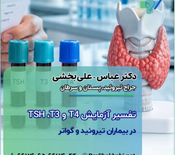 تفسیر آزمایش TSH ،T3 و T4 در بیماران تیروئید و گواتر؛ و چه زمانی نیاز به جراحی دارند؟