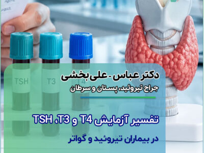 تفسیر آزمایش TSH ،T3 و T4 در بیماران تیروئید و گواتر؛ و چه زمانی نیاز به جراحی دارند؟ تفسیر آزمایش TSH ،T3 و T4 در بیماران تیروئید و گواتر؛ و چه زمانی نیاز به جراحی دارند؟